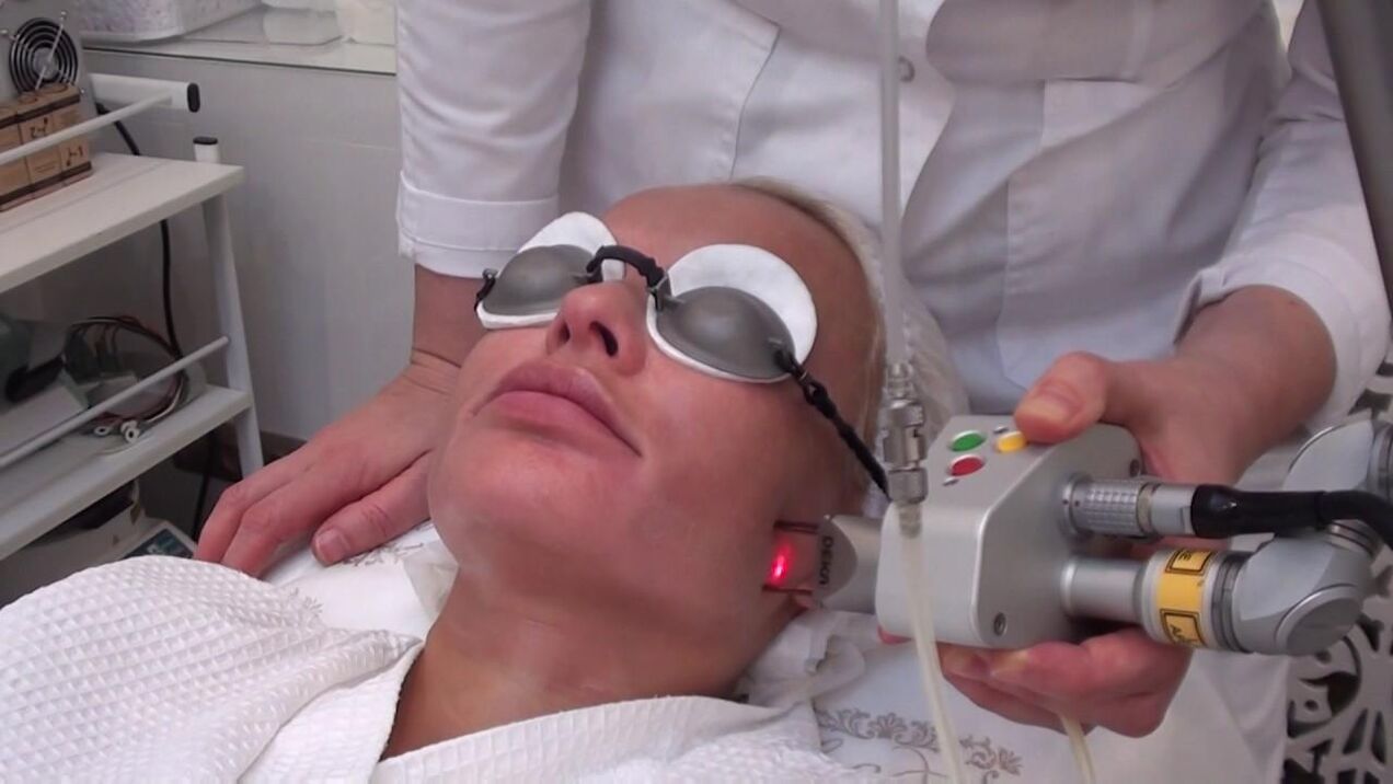 Laser treatment for problem areas of the face